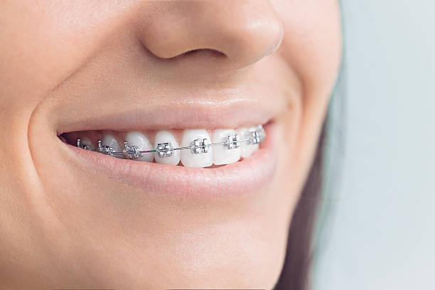 Best Invisalign and Clear Aligners  in Bermuda Dunes, CA